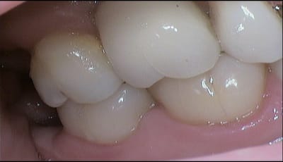 Ljgvrx7oymii0xo79mm51nwuwe9k - Eugenol