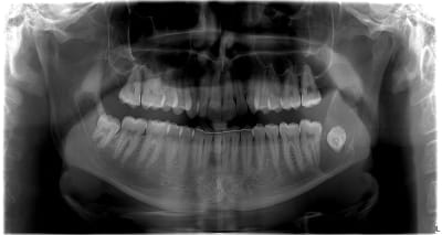 Lmmrtwlruyobazqulut6 - Eugenol