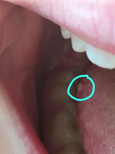 Lxzahxhtztopoqln0gfw - Eugenol