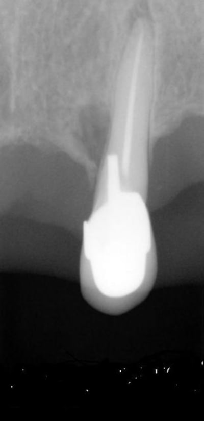 Machinchose oi18kl - Eugenol