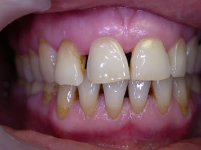 Madame t5atb xw6lpz - Eugenol