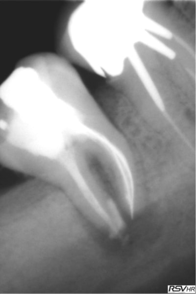 Marroux2 l2uwxk - Eugenol