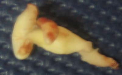 Mary2 tul9el - Eugenol