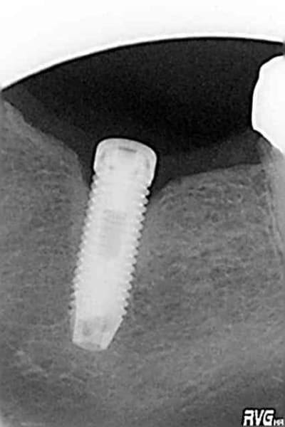 Masc2 slps9h - Eugenol