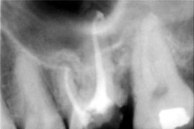 Maz 2 zzfeqq - Eugenol