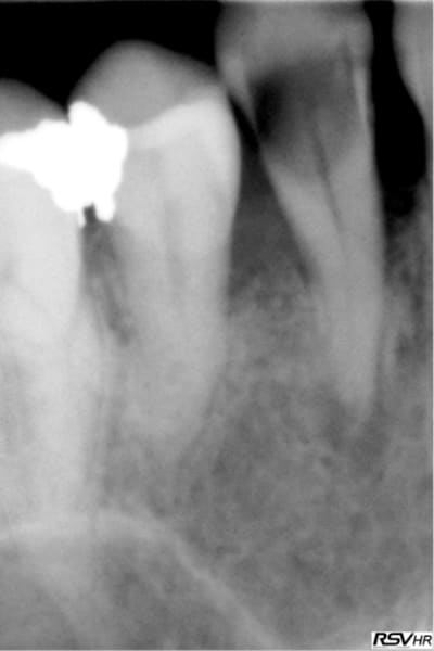 Mekb1 zxxn3g - Eugenol