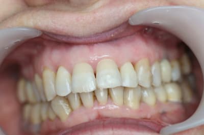 Mi3 p5ji3t - Eugenol