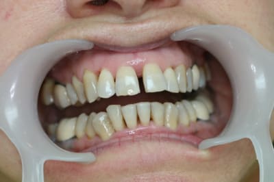 Mi initial hxsfad - Eugenol