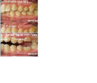 Mini cales pcgznh - Eugenol