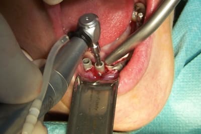 Mise en charge direct027 mbu7g0 - Eugenol