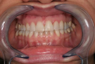 Mockup 3 mvqhom - Eugenol