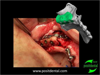 Mod le 3d st rile guide de d coupe 3 l8ny3i - Eugenol