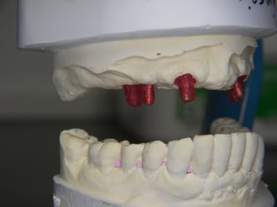 Modele de finition lopizu - Eugenol