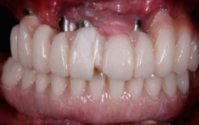 Mon beau sourire qp8vjd xtvg4t - Eugenol