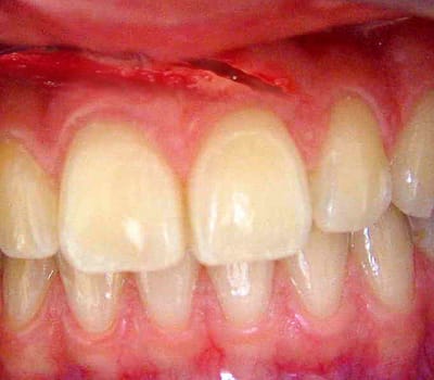 Mothet2 copy ou8acb - Eugenol