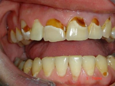Mr ml ol9qvi - Eugenol