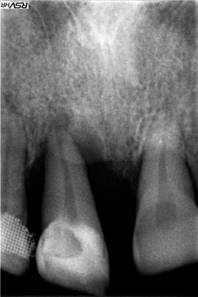 Mr noel e3ioag - Eugenol