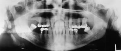 Nigma1 slyi5k - Eugenol