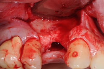 Nunalap4lfncm4oanx3a - Eugenol