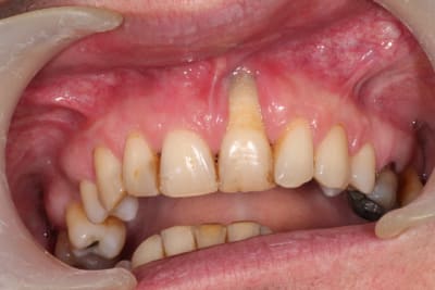 Oct 2013 036 urnjwm - Eugenol