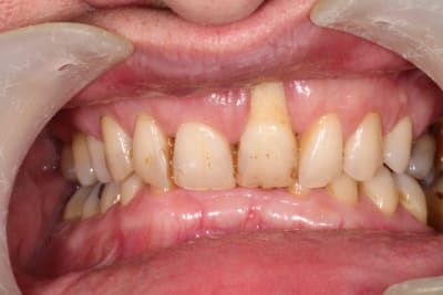 Oct 2013 038 fkyqye - Eugenol