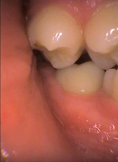 Odf bebbea - Eugenol