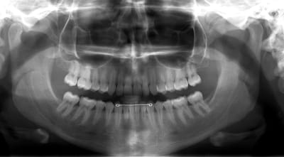 Opt wfudzf - Eugenol