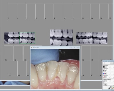 Orkgx8ejmuyjsbi5udws - Eugenol