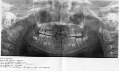 Ortho01 xovios - Eugenol