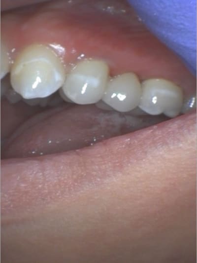 P2 x4q2ow - Eugenol