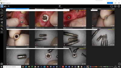 P79p1f25k6pja04y7dvxdwl6zg4e - Eugenol