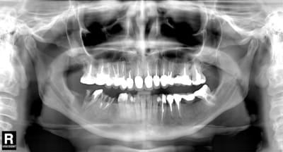 Pano port hel bcubud - Eugenol