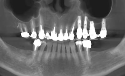 Pano1 dlk2fk - Eugenol