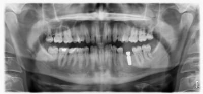 Pano1 nft64f - Eugenol