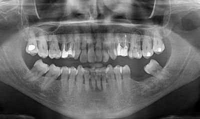 Panoemci r7nfz9 - Eugenol