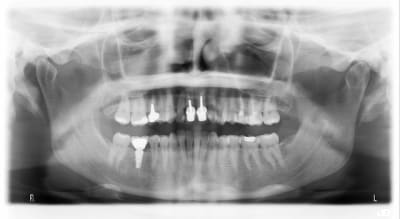 Pano  2  gcudrk - Eugenol