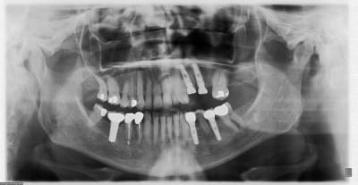 Pano  2  hbmbgk - Eugenol
