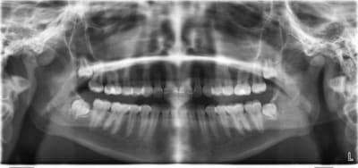 Pano  jrgexh - Eugenol