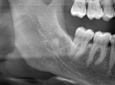 Pano btqblt - Eugenol