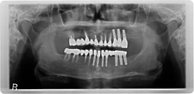 Pano controle du jour gceciq - Eugenol