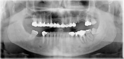 Pano dds gthjhy - Eugenol