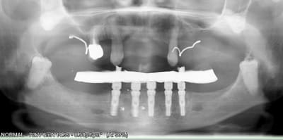 Pano fin w9e32j - Eugenol