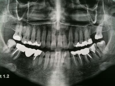 Pano lm8guf - Eugenol