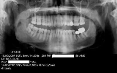 Pano mqxc1x - Eugenol