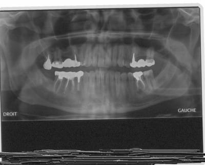 Pano pour eugenol lzrpqy - Eugenol