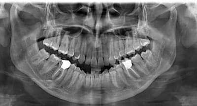 Pano scan qyeynn - Eugenol