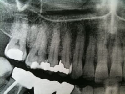 Pano secteur 1 wwhefc - Eugenol