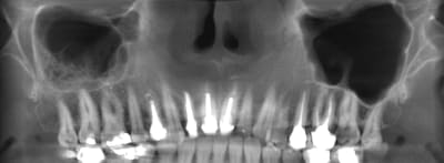 Pano sggyab - Eugenol