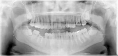 Panoramique granul s bfcmld - Eugenol