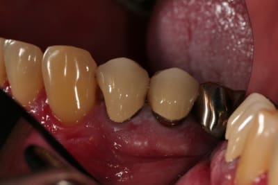 Paro 2 atppke - Eugenol